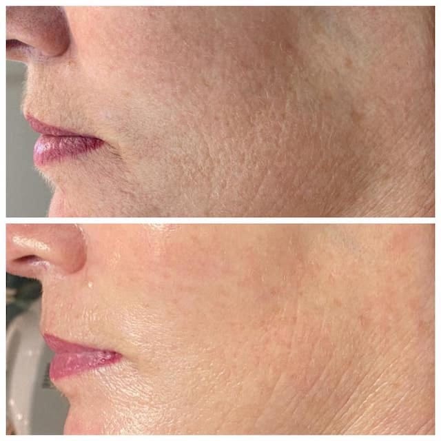 Before & After Photo 10