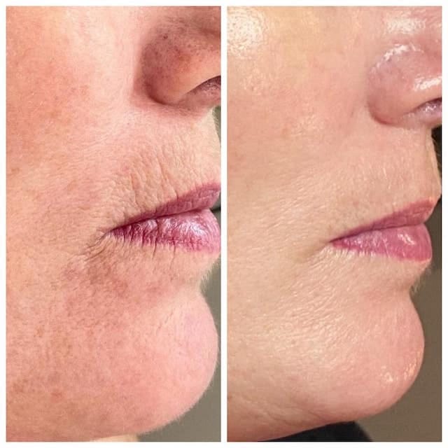 Before & After Photo 11