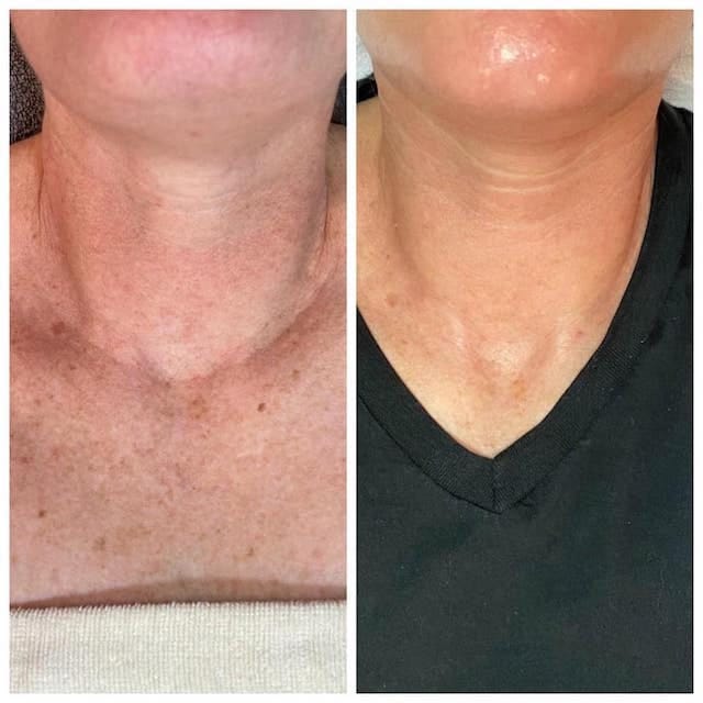 Before & After Photo 12