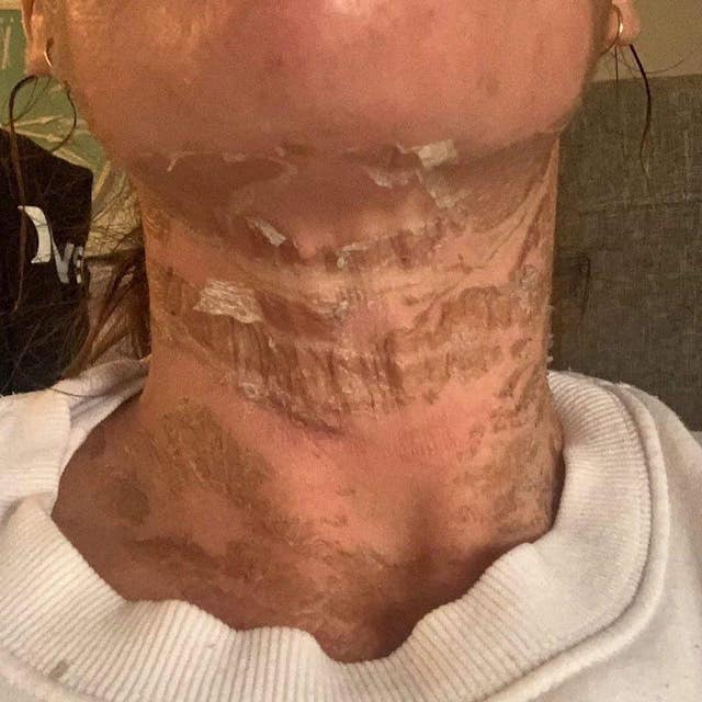 Before & After Photo 13