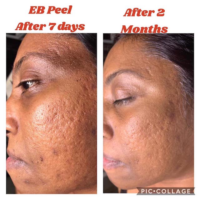 Before & After Photo 15