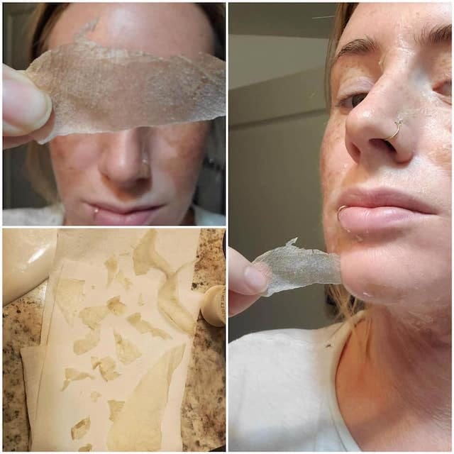 Before & After Photo 21