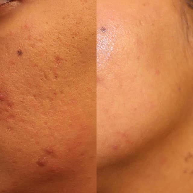 Before & After Photo 22