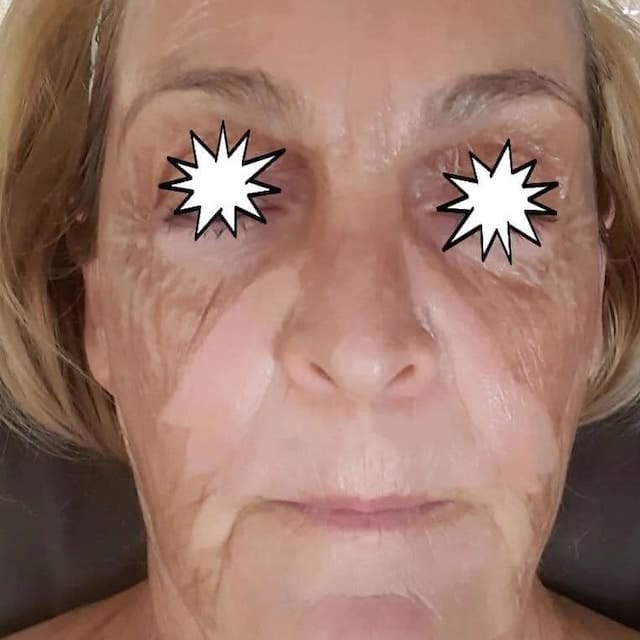 Before & After Photo 23