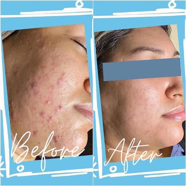 Before & After Photo 26