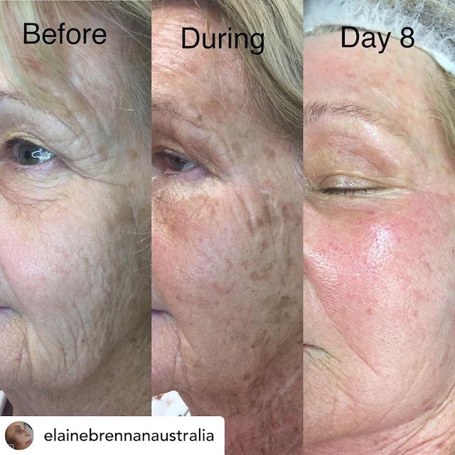 Before & After Photo 30