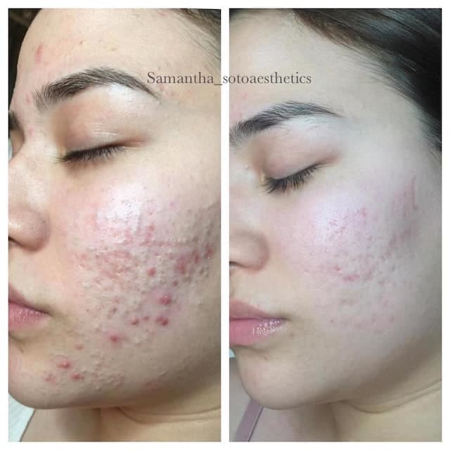 Before & After Photo 5