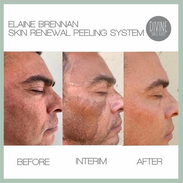 Before & After Photo 7