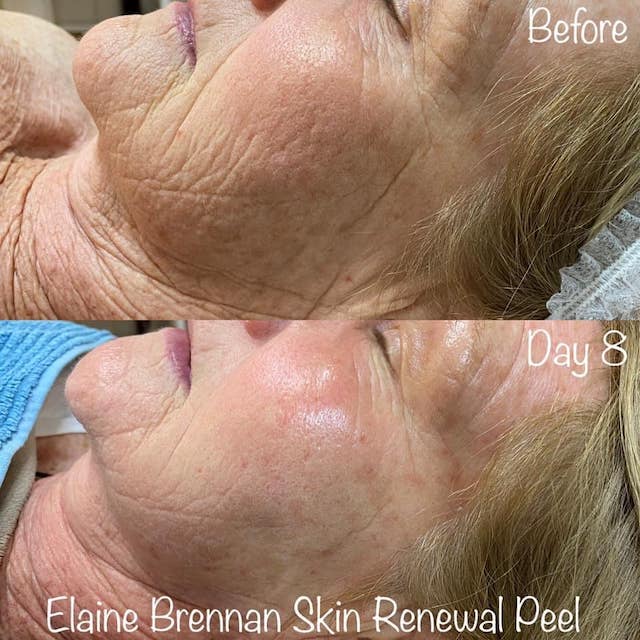 Before & After Photo 8